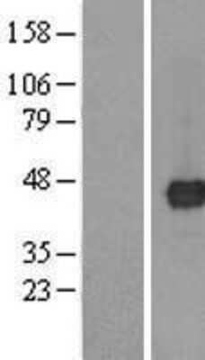 Western Blot: TMED8 Overexpression Lysate (Adult Normal) [NBL1-16985] Left-Empty vector transfected control cell lysate (HEK293 cell lysate); Right -Over-expression Lysate for TMED8.