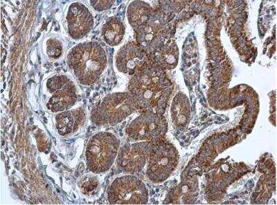 Immunohistochemistry-Paraffin: TMED9 Antibody [NBP1-31650] -  Mouse duodenum. TMED9 antibody [N1C3] diluted at 1:500. Antigen Retrieval: Citrate buffer, pH 6.0, 15 min.