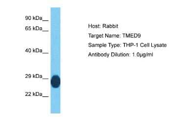 Western Blot: TMED9 Antibody [NBP2-85935] - Host: Rabbit. Target Name: TMED9. Sample Tissue: Human THP-1 Whole Cell lysates. Antibody Dilution: 1ug/ml