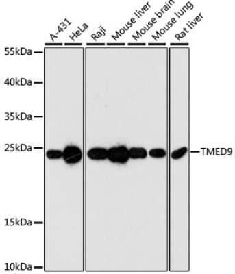 Western Blot: TMED9 Antibody [NBP2-94854] - Analysis of extracts of various cell lines, using TMED9 at 1:3000 dilution. Secondary antibody: HRP Goat Anti-Rabbit IgG (H+L) at 1:10000 dilution. Lysates/proteins: 25ug per lane. Blocking buffer: 3% nonfat dry milk in TBST. Detection: ECL Basic Kit . Exposure time: 90s.