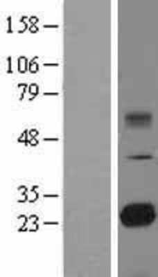 Western Blot: TMED9 Overexpression Lysate (Adult Normal) [NBL1-16986] Left-Empty vector transfected control cell lysate (HEK293 cell lysate); Right -Over-expression Lysate for TMED9.