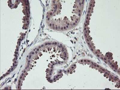 Immunohistochemistry: TMEFF2/Tomoregulin-2 Antibody (OTI1F9) - Azide and BSA Free [NBP2-74537] - Staining of paraffin-embedded Human breast tissue using anti-TMEFF2 mouse monoclonal antibody.