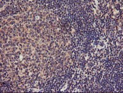 Immunohistochemistry: TMEFF2/Tomoregulin-2 Antibody (OTI1F9) - Azide and BSA Free [NBP2-74537] - Staining of paraffin-embedded Human tonsil using anti-TMEFF2 mouse monoclonal antibody.