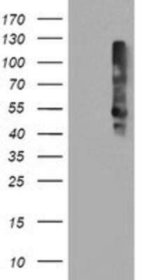 Western Blot: TMEFF2/Tomoregulin-2 Antibody (OTI1F9) - Azide and BSA Free [NBP2-74537] - HEK293T cells were transfected with the pCMV6-ENTRY control (Left lane) or pCMV6-ENTRY TMEFF2 (Right lane) cDNA for 48 hrs and lysed. Equivalent amounts of cell lysates (5 ug per lane) were separated by SDS-PAGE and immunoblotted with anti-TMEFF2.