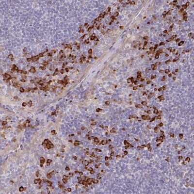 Immunohistochemistry-Paraffin: TMEM1 Antibody [NBP2-48963] - Staining of human tonsil shows cytoplasmic positivity in non-germinal center cells.