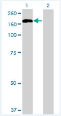 Western Blot: TMEM1 Antibody [H00007109-B01P-50ug] - Analysis of TRAPPC10 expression in transfected 293T cell line  H00007109-T01) by TRAPPC10 MaxPab polyclonal antibody.  Lane 1: TMEM1 transfected lysate(138.49 KDa). WLane 2: Non-transfected lysate.