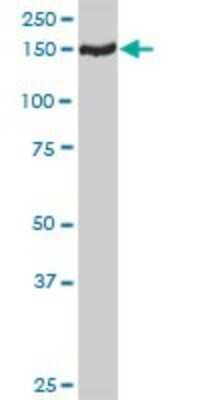 Western Blot: TMEM1 Antibody [H00007109-D01P] - Analysis of TMEM1 expression in HepG2.