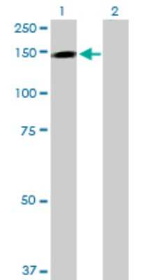 Western Blot: TMEM1 Antibody [H00007109-D01P] - Analysis of TRAPPC10 expression in transfected 293T cell line by TRAPPC10 polyclonal antibody.Lane 1: TMEM1 transfected lysate(142.20 KDa).Lane 2: Non-transfected lysate.