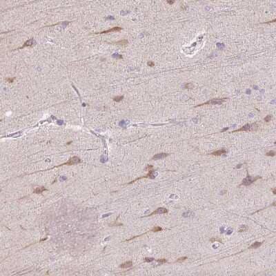 Immunohistochemistry-Paraffin TMEM100 Antibody - BSA Free