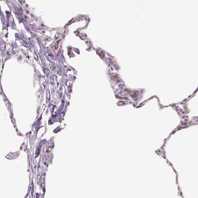 Immunohistochemistry-Paraffin TMEM100 Antibody - BSA Free