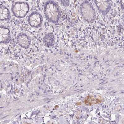 Immunohistochemistry-Paraffin TMEM100 Antibody - BSA Free