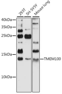 Western Blot: TMEM100 Antibody [NBP2-94746] - Analysis of extracts of various cell lines, using TMEM100 at 1:1000 dilution. Secondary antibody: HRP Goat Anti-Rabbit IgG (H+L) at 1:10000 dilution. Lysates/proteins: 25ug per lane. Blocking buffer: 3% nonfat dry milk in TBST. Detection: ECL Basic Kit . Exposure time: 90s.