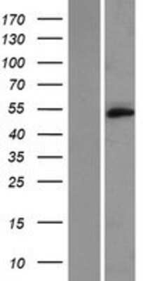Western Blot: TMEM102 Overexpression Lysate (Adult Normal) [NBP2-04959] Left-Empty vector transfected control cell lysate (HEK293 cell lysate); Right -Over-expression Lysate for TMEM102.