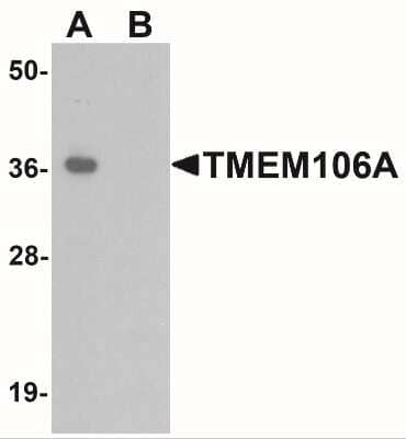 Western Blot: TMEM106A Antibody [NBP2-41165] - Western blot analysis of TMEM106A in A-20 cell lysate with TMEM106A antibody at 1 ug/mL in (A) the absence and (B) the presence of blocking peptide.