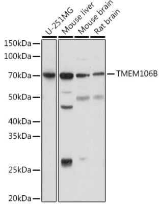 Western Blot: TMEM106B Antibody [NBP3-15966] - Analysis of extracts of various cell lines, using TMEM106B antibody (NBP3-15966) at 1:1000 dilution. Secondary antibody: HRP Goat Anti-Rabbit IgG (H+L) at 1:10000 dilution. Lysates/proteins: 25ug per lane. Blocking buffer: 3% nonfat dry milk in TBST. Detection: ECL Basic Kit. Exposure time: 5s.