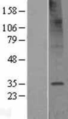 Western Blot: TMEM106C Overexpression Lysate (Adult Normal) [NBL1-16995] Left-Empty vector transfected control cell lysate (HEK293 cell lysate); Right -Over-expression Lysate for TMEM106C.