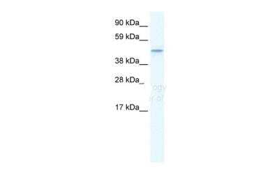 Western Blot: TMEM108 Antibody [NBP1-57849] - WB Suggested Anti-TMEM108 Antibody Titration: 1.25ug/mlELISA Titer: 1:312500Positive Control: Human brain