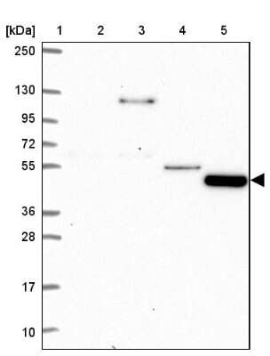 Western Blot: TMEM108 Antibody [NBP2-38991] - Lane 1: Marker  [kDa] 250, 130, 95, 72, 55, 36, 28, 17, 10.  Lane 2: Human cell line RT-4.  Lane 3: Human cell line U-251MG.  Lane 4: Human Plasma.  Lane 5: Human liver tissue