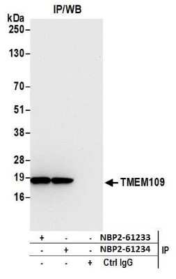 Western Blot: TMEM109 Antibody [NBP2-61234] - Detection of human TMEM109 by western blot of immunoprecipitates. Samples: Whole cell lysate (1.0 mg per IP reaction; 20% of IP loaded) from 293T cells prepared using NETN lysis buffer. Antibodies: Affinity purified rabbit anti-TMEM109 antibody NBP2-61234 used for IP at 20 ul per reaction. TMEM109 was also immunoprecipitated by rabbit anti-TMEM109 antibody NBP2-61233. For blotting immunoprecipitated TMEM109, NBP2-61234 was used at 1:100. Detection: Chemiluminescence with an exposure time of 10 seconds.