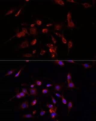 Immunocytochemistry/Immunofluorescence: TMEM11 Antibody [NBP2-93465] - Analysis of C6 cells using TMEM11 at dilution of 1:100. Blue: DAPI for nuclear staining.