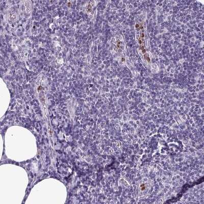 Immunohistochemistry-Paraffin: TMEM11 Antibody [NBP2-13443] - Staining of human lymph node shows strong positivity in a subset of leukocytes.