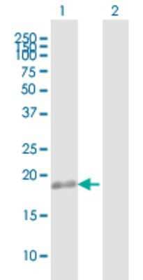 Western Blot: TMEM11 Antibody [H00008834-B01P] - Analysis of TMEM11 expression in transfected 293T cell line by TMEM11 polyclonal antibody.  Lane 1: TMEM11 transfected lysate(21.50 KDa). Lane 2: Non-transfected lysate.