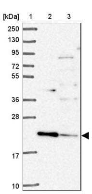 Western Blot: TMEM11 Antibody [NBP2-13443] - Lane 1: Marker  [kDa] 250, 130, 95, 72, 55, 36, 28, 17, 10.  Lane 2: Human cell line RT-4.  Lane 3: Human cell line U-251MG sp