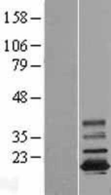 Western Blot: TMEM11 Overexpression Lysate (Adult Normal) [NBL1-16998] Left-Empty vector transfected control cell lysate (HEK293 cell lysate); Right -Over-expression Lysate for TMEM11.