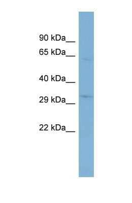 Western Blot: TMEM110 Antibody [NBP1-69238] - This Anti-TMEM110 antibody was used in Western Blot of 721_B     tissue lysate at a concentration of 1ug/ml.