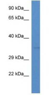 Western Blot: TMEM110 Antibody [NBP1-74232] - Rat Liver Lysate 1ug/ml  Gel Concentration 12%