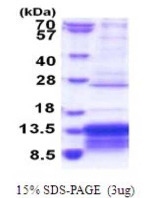 SDS-PAGE Recombinant Human MUSTN1 His Protein