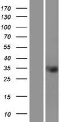 Western Blot TMEM110 Overexpression Lysate