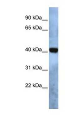 Western Blot: TMEM115 Antibody [NBP1-69572] - This Anti-TMEM115 antibody was used in Western Blot of Fetal Brain   tissue lysate at a concentration of 1ug/ml.