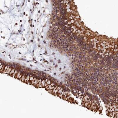 Immunohistochemistry-Paraffin: TMEM116 Antibody [NBP1-81881] - Staining of human nasopharynx shows strong cytoplasmic and membranous positivity in respiratory epithelial cells.