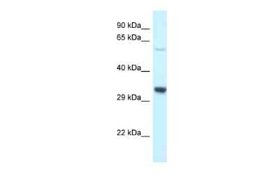 Western Blot: TMEM117 Antibody [NBP2-88439] - WB Suggested Anti-Tmem117 Antibody. Titration: 1.0 ug/ml. Positive Control: Rat liver