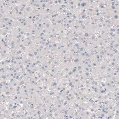 Immunohistochemistry-Paraffin: TMEM119 Antibody (CL8714) [NBP2-76985] - Staining of human liver shows no positivity in hepatocytes as expected.