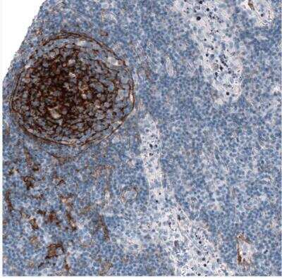 Immunohistochemistry-Paraffin: TMEM119 Antibody (CL8714) [NBP2-76985] - Staining of human lymphoid tissues shows strong membranous positivity in germinal center cells.