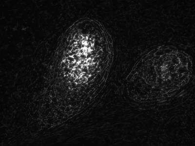 Immunohistochemistry-Paraffin: TMEM119 Antibody (CL8714) [NBP2-76985] - TMEM119 on human FFPE tonsil, 1:100 and pH 9 antigen retrieval. Image submitted by a verified customer review. 