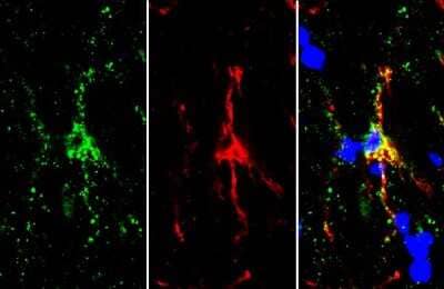 Immunohistochemistry-Frozen: TMEM119 Antibody [NBP3-13355] - TMEM119 antibody detects TMEM119 protein by immunohistochemical analysis. Sample: Frozen-sectioned mouse brain. Red: TMEM119 stained by TMEM119 antibody (NBP3-13355) diluted at 1:250. Green: Iba1 (isoform 1 and 3), stained by Iba1 (isoform 1 and 3) antibody, C-term diluted at 1:250. Blue: Hoechst 33342 staining.