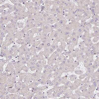 Immunohistochemistry-Paraffin: TMEM119 Antibody [NBP2-30792] - Staining of human liver shows no positivity in hepatocytes as expected.