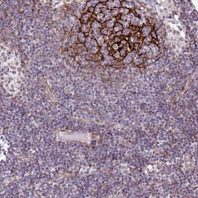 <b>Independent Antibodies Validation. </b>Immunohistochemistry-Paraffin: TMEM119 Antibody [NBP2-30792] - Staining of human lymph node strong positivity in reticular fibers in germinal center cells.