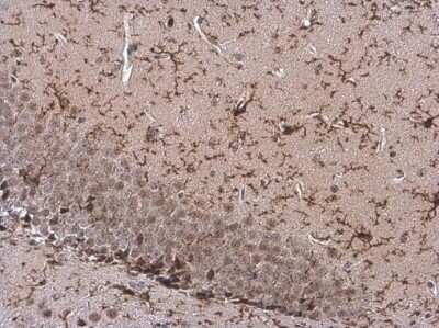 Immunohistochemistry-Paraffin: TMEM119 Antibody [NBP3-13355] - Mouse hippocampus. TMEM119 stained by TMEM119 antibody (NBP3-13355) diluted at 1:250. Antigen Retrieval: Citrate buffer, pH 6.0, 15 min.