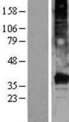 Western Blot: TMEM120A Overexpression Lysate (Adult Normal) [NBL1-17003] Left-Empty vector transfected control cell lysate (HEK293 cell lysate); Right -Over-expression Lysate for TMEM120A.