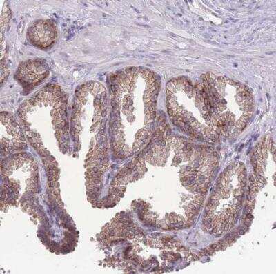 Immunohistochemistry-Paraffin: TMEM121 Antibody [NBP2-14693] - Staining of human prostate shows moderate cytoplasmic positivity in glandular cells.