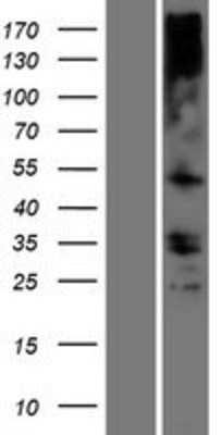 Western Blot: TMEM121 Overexpression Lysate (Adult Normal) [NBP2-06224] Left-Empty vector transfected control cell lysate (HEK293 cell lysate); Right -Over-expression Lysate for TMEM121.