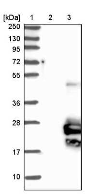 Western Blot: TMEM125 Antibody [NBP1-81186] - Lane 1: Marker [kDa] 250, 130, 95, 72, 55, 36, 28, 17, 10Lane 2: Negative control (vector only transfected HEK293T lysate)Lane 3: Over-expression lysate (Co-expressed with a C-terminal myc-DDK tag (~3.1 kDa) in mammalian HEK293T cells, LY408257)