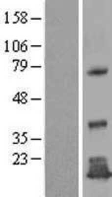 Western Blot: TMEM125 Overexpression Lysate (Adult Normal) [NBL1-17005] Left-Empty vector transfected control cell lysate (HEK293 cell lysate); Right -Over-expression Lysate for TMEM125.