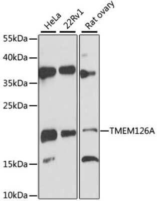 Western Blot: TMEM126A Antibody [NBP2-93371] - Analysis of extracts of various cell lines, using TMEM126A . Exposure time: 90s.