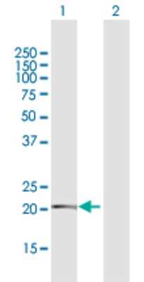 Western Blot: TMEM126B Antibody [H00055863-D01P] - Analysis of TMEM126B expression in transfected 293T cell line by TMEM126B polyclonal antibody.Lane 1: TMEM126B transfected lysate(22.80 KDa).Lane 2: Non-transfected lysate.