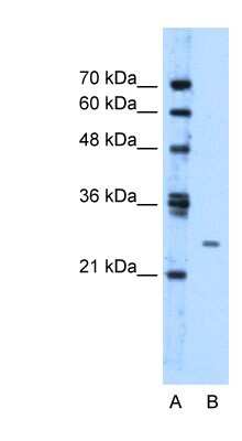 Western Blot: TMEM126B Antibody [NBP1-59978] - Jurkat cell lysate, concentration 1.25ug/ml.